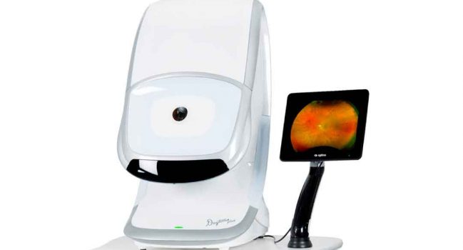 Optomap Ultra-widefield retinal imaging