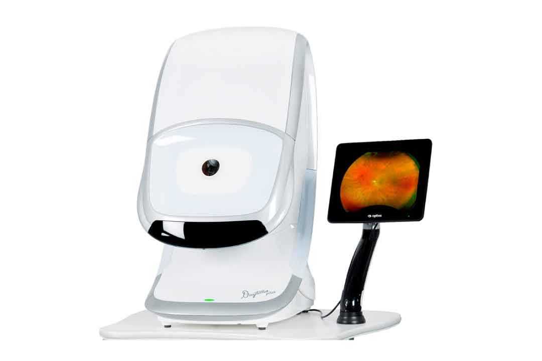 Optomap Ultra-widefield retinal imaging